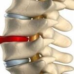 vertebrae